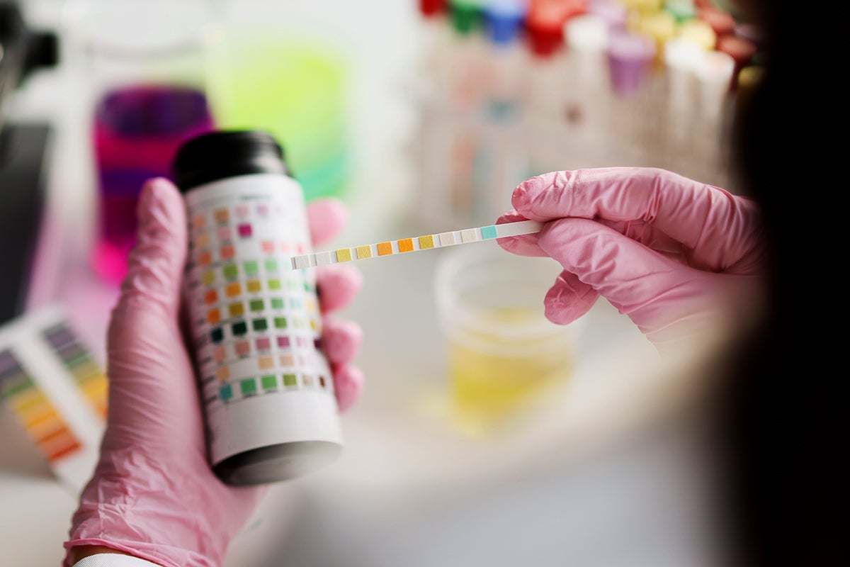 When to test for ketones in urine and why it matters Optum Perks